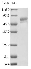 (Tris-Glycine gel) Discontinuous SDS-PAGE (reduced) with 5% enrichment gel and 15% separation gel.