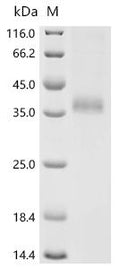 (Tris-Glycine gel) Discontinuous SDS-PAGE (reduced) with 5% enrichment gel and 15% separation gel.