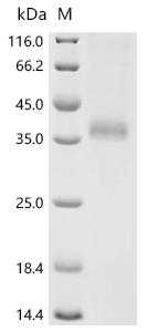(Tris-Glycine gel) Discontinuous SDS-PAGE (reduced) with 5% enrichment gel and 15% separation gel.