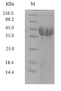 (Tris-Glycine gel) Discontinuous SDS-PAGE (reduced) with 5% enrichment gel and 15% separation gel.