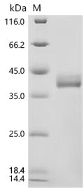 (Tris-Glycine gel) Discontinuous SDS-PAGE (reduced) with 5% enrichment gel and 15% separation gel.