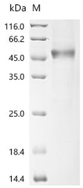 (Tris-Glycine gel) Discontinuous SDS-PAGE (reduced) with 5% enrichment gel and 15% separation gel.