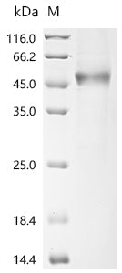 (Tris-Glycine gel) Discontinuous SDS-PAGE (reduced) with 5% enrichment gel and 15% separation gel.