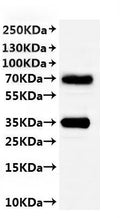 CSB-MP837739MO(A4) is detected by Mouse anti-6*His monoclonal antibody