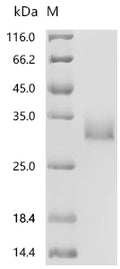 (Tris-Glycine gel) Discontinuous SDS-PAGE (reduced) with 5% enrichment gel and 15% separation gel.