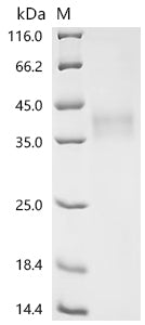 (Tris-Glycine gel) Discontinuous SDS-PAGE (reduced) with 5% enrichment gel and 15% separation gel.