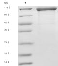 (Tris-Glycine gel) Discontinuous SDS-PAGE (reduced) with 5% enrichment gel and 15% separation gel.