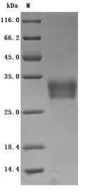 (Tris-Glycine gel) Discontinuous SDS-PAGE (reduced) with 5% enrichment gel and 15% separation gel.