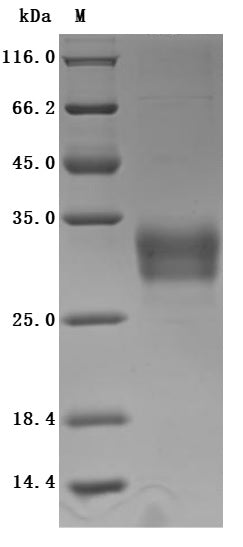 (Tris-Glycine gel) Discontinuous SDS-PAGE (reduced) with 5% enrichment gel and 15% separation gel.