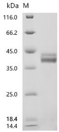 (Tris-Glycine gel) Discontinuous SDS-PAGE (reduced) with 5% enrichment gel and 15% separation gel.
