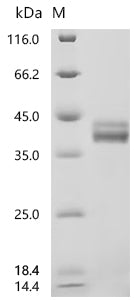 (Tris-Glycine gel) Discontinuous SDS-PAGE (reduced) with 5% enrichment gel and 15% separation gel.