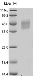 (Tris-Glycine gel) Discontinuous SDS-PAGE (reduced) with 5% enrichment gel and 15% separation gel.