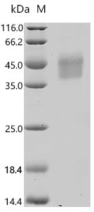 (Tris-Glycine gel) Discontinuous SDS-PAGE (reduced) with 5% enrichment gel and 15% separation gel.