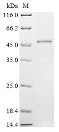 (Tris-Glycine gel) Discontinuous SDS-PAGE (reduced) with 5% enrichment gel and 15% separation gel.