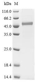 (Tris-Glycine gel) Discontinuous SDS-PAGE (reduced) with 5% enrichment gel and 15% separation gel.