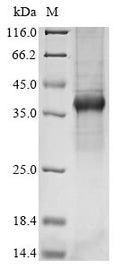 (Tris-Glycine gel) Discontinuous SDS-PAGE (reduced) with 5% enrichment gel and 15% separation gel.