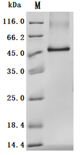 (Tris-Glycine gel) Discontinuous SDS-PAGE (reduced) with 5% enrichment gel and 15% separation gel.