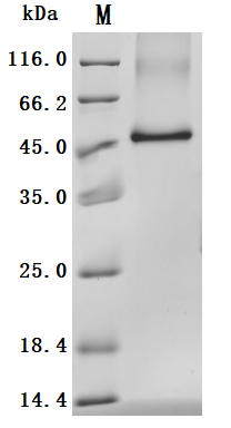 (Tris-Glycine gel) Discontinuous SDS-PAGE (reduced) with 5% enrichment gel and 15% separation gel.