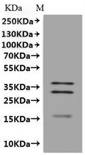 CSB-MP890691HU is detected by Mouse anti-6*His monoclonal antibody.