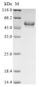 (Tris-Glycine gel) Discontinuous SDS-PAGE (reduced) with 5% enrichment gel and 15% separation gel.
