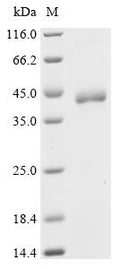 (Tris-Glycine gel) Discontinuous SDS-PAGE (reduced) with 5% enrichment gel and 15% separation gel.