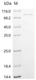 (Tris-Glycine gel) Discontinuous SDS-PAGE (reduced) with 5% enrichment gel and 15% separation gel.