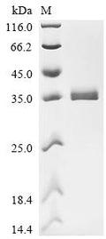 (Tris-Glycine gel) Discontinuous SDS-PAGE (reduced) with 5% enrichment gel and 15% separation gel.
