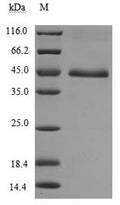 (Tris-Glycine gel) Discontinuous SDS-PAGE (reduced) with 5% enrichment gel and 15% separation gel.