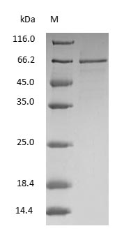 (Tris-Glycine gel) Discontinuous SDS-PAGE (reduced) with 5% enrichment gel and 15% separation gel.