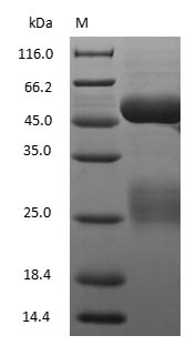 (Tris-Glycine gel) Discontinuous SDS-PAGE (reduced) with 5% enrichment gel and 15% separation gel.