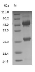 (Tris-Glycine gel) Discontinuous SDS-PAGE (reduced) with 5% enrichment gel and 15% separation gel.