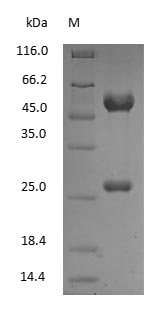 (Tris-Glycine gel) Discontinuous SDS-PAGE (reduced) with 5% enrichment gel and 15% separation gel.