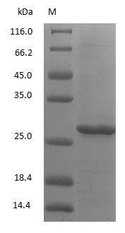 (Tris-Glycine gel) Discontinuous SDS-PAGE (reduced) with 5% enrichment gel and 15% separation gel.
