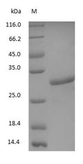 (Tris-Glycine gel) Discontinuous SDS-PAGE (reduced) with 5% enrichment gel and 15% separation gel.