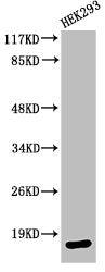 Western Blot analysis of HEK293 cells using Cleaved-Caspase-3 p17 (D175) Polyclonal Antibody
