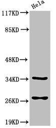 Western Blot analysis of HeLa cells using Cleaved-Caspase-6 p18 (D162) Polyclonal Antibody