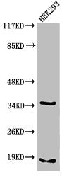 Western Blot analysis of 293 cells using Cleaved-Caspase-6 p18 (D179) Polyclonal Antibody