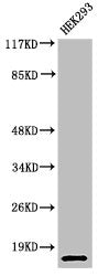 Western Blot analysis of 293 cells using Cleaved-Caspase-7 (S199) Polyclonal Antibody