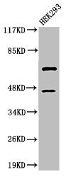 Western Blot analysis of 293 cells using Cleaved-Caspase-8 (D384) Polyclonal Antibody