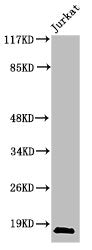 Western Blot analysis of Jurkat cells using Cleaved-Caspase-2 p18 (G170) Polyclonal Antibody