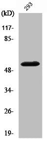 Western Blot analysis of 293 cells using Cleaved-MMP-14 (Y112) Polyclonal Antibody