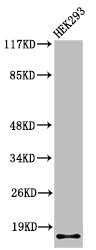 Western Blot analysis of 293 cells using Cleaved-Integrin α5 LC (E895) Polyclonal Antibody