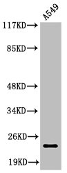 Cleaved-PARP1 (D214) Antibody – Figure 1 of 2