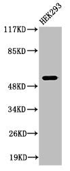 Western Blot analysis of 293 cells using Cleaved-Plasminogen HC A short form (V98) Polyclonal Antibody