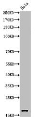 Western Blot analysis of Hela cells using Acetyl-Histone H3 (K27) Polyclonal Antibody