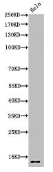 Western Blot analysis of HELA cells using Acetyl-Histone H4 (K5) Polyclonal Antibody