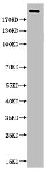 Western Blot analysis of various cells using Acetyl-CBP (K1535) Polyclonal Antibody