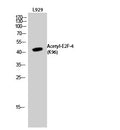 Western Blot analysis of L929 cells using Acetyl-E2F-4 (K96) Polyclonal Antibody