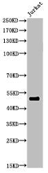 Western Blot analysis of JK cells using Acetyl-HNF-3α/β/&gamma;(K264/253/211) Polyclonal Antibody