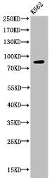 Western Blot analysis of K562 cells using Acetyl-HSP 90 (K292/284) Polyclonal Antibody